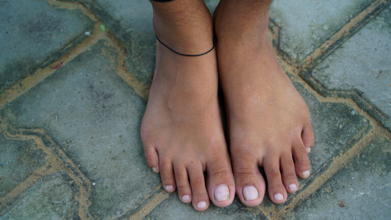 Why Do So Many People Wear a Black Thread on Their Leg?