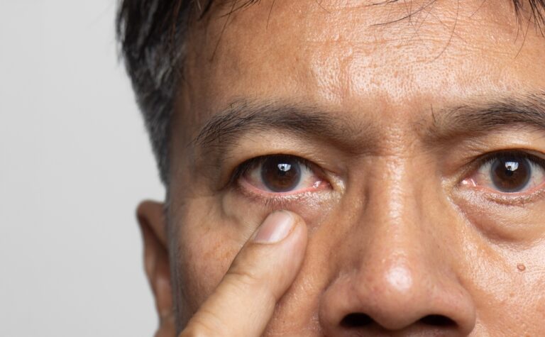 Men, Is Your Right Eye Twitching? The Shocking Astrological Reason Revealed